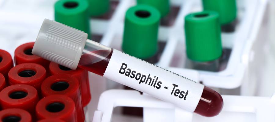 Bazofil (baso) etiketi taşıyan bir kan örneği tüpü, laboratuvar test tüpleri arasında yer alıyor. Görsel, bazofil testinin laboratuvar ortamındaki örnekleme sürecini temsil ediyor.