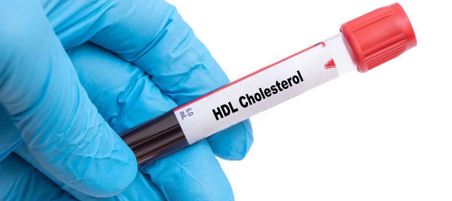 HDL Kolesterol testi için alınmış kan örneğini tutan mavi eldivenli bir el.