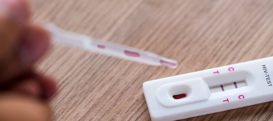 Ahşap bir yüzey üzerinde bulunan HIV hızlı test kiti. Test çubuğunda “C” ve “T” harflerinin hizasında iki pembe çizgi görünüyor. Ön planda bir damla kan içeren damlalık bulunuyor.