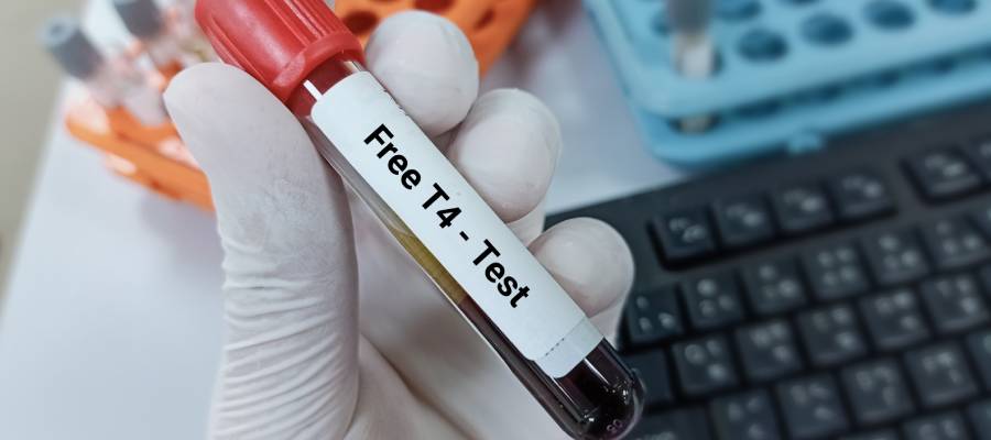 Serbest T4 testi için alınmış kan örneğini gösteren, 'Free T4 - Test' etiketi taşıyan tüpü elinde tutan laboratuvar görevlisi