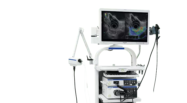 EUS (Endoskopik Ultrasonografi)