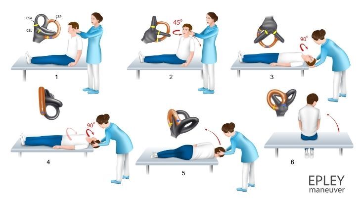 Epley Manevrası Nedir? Epley Manevrası Nasıl Yapılır?