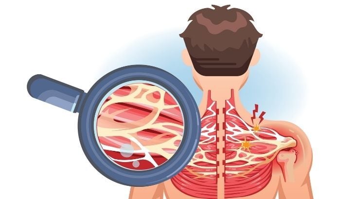 Fasya Nedir? Fasya Egzersizleri Nelerdir?