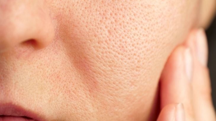 Gözenek Nedir? Gözenek Sıkılaştırıcı Yöntemler Nelerdir?